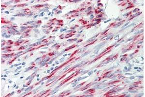 Image no. 2 for anti-Cytoplasmic Polyadenylation Element Binding Protein 2 (CPEB2) (AA 543-592) antibody (ABIN6749718)