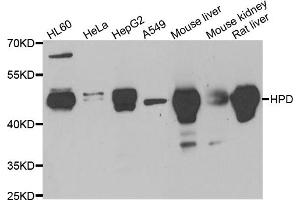 Western blot analysis of extracts of various cell lines, using HPD antibody (ABIN5973894) at 1/1000 dilution.