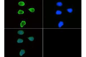 Immunofluorescence of Rabbit Anti-Histone H3 [Trimethyl Lys9] Antibody.