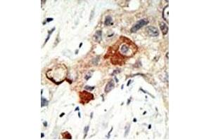 Image no. 1 for anti-Ubiquitin-Conjugating Enzyme E2I (UBE2I) (N-Term) antibody (ABIN356594)