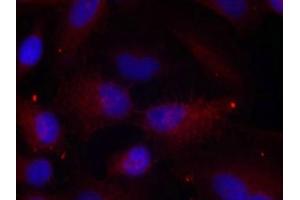 Immunofluorescence staining of methanol-fixed Hela cells using PAK1/PAK2/PAK3(Phospho-Thr423/Thr402/Thr421) Antibody.