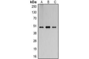 Western blot analysis of Flotillin 2 expression in A431 (A), mouse brain (B), rat brain (C) whole cell lysates.