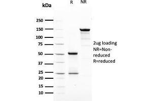 SDS-PAGE Analysis Purified HER-2 Mouse Monoclonal Antibody (ERBB2/3079). (ErbB2/Her2 anticorps  (AA 311-462))