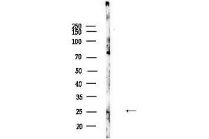 anti-RAB7, Member RAS Oncogene Family-Like 1 (RAB7L1) (Internal Region) antibody