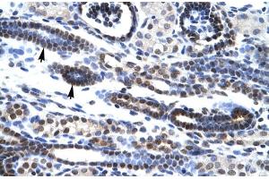 Rabbit Anti-HES7 Antibody Catalog Number: ARP30035 Paraffin Embedded Tissue: Human Kidney Cellular Data: Epithelial cells of renal tubule Antibody Concentration: 4.