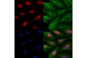 ABIN6259751 and ABIN6278986 staining  cells by IF/ICC. (Actin-Like 6B anticorps  (Internal Region))