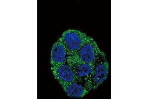 Confocal immunofluorescent analysis of PLA2G6 Antibody with HepG2 cell followed by Alexa Fluor488-conjugated goat anti-rabbit lgG (green). (PLA2G6 anticorps  (AA 551-580))