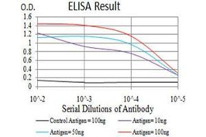 Black line: Control Antigen (100 ng), Purple line: Antigen(10 ng), Blue line: Antigen (50 ng), Red line: Antigen (100 ng),