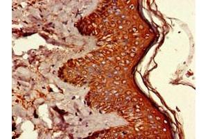 Immunohistochemistry of paraffin-embedded human skin tissue using ABIN7174224 at dilution of 1:100 (Ubiquilin 1 anticorps  (AA 1-300))