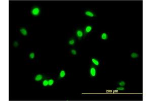 Immunofluorescence of monoclonal antibody to AATF on HeLa cell. (AATF anticorps  (AA 151-250))