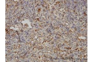 Image no. 1 for anti-Synaptosomal-Associated Protein, 23kDa (SNAP23) (AA 1-212) antibody (ABIN599065) (SNAP23 anticorps  (AA 1-212))