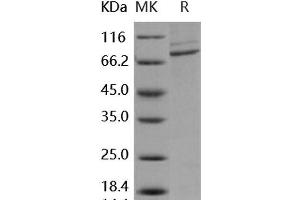 Western Blotting (WB) image for Colony Stimulating Factor 1 Receptor (CSF1R) protein (GST tag,His tag) (ABIN7317115)