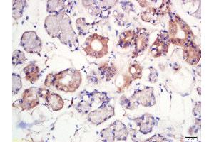 Formalin-fixed and paraffin embedded human larynx labeled with Rabbit Anti-MFSD2A Polyclonal Antibody, Unconjugated  at 1:200 followed by conjugation to the secondary antibody and DAB staining (MFSD2A anticorps  (AA 331-430))
