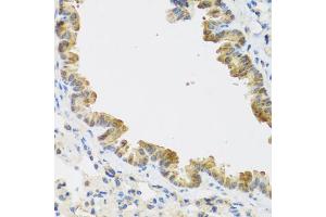 Immunohistochemistry of paraffin-embedded mouse lung using CDKN2C antibody (ABIN5971074) at dilution of 1/100 (40x lens). (CDKN2C anticorps)
