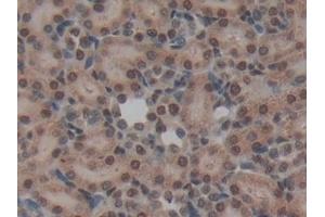 Detection of NME6 in Rat Kidney Tissue using Polyclonal Antibody to Non Metastatic Cells 6, Protein Expressed In (NME6)