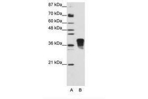 Image no. 2 for anti-Transformer 2 beta Homolog (TRA2B) (N-Term) antibody (ABIN202162) (TRA2B anticorps  (N-Term))