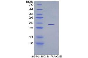 SDS-PAGE analysis of Human ADAMTS12 Protein. (ADAMTS12 Protéine)