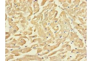 Immunohistochemistry of paraffin-embedded human heart tissue using ABIN7170255 at dilution of 1:100