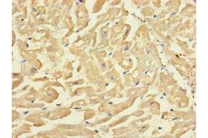 Immunohistochemistry of paraffin-embedded human heart tissue using ABIN7170255 at dilution of 1:100 (SLC43A3 anticorps  (AA 209-278))
