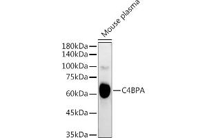 Western blot analysis of extracts of Mouse plasma, using C4BPA antibody (ABIN6134574, ABIN6137773, ABIN6137774 and ABIN6223565) at 1:3000 dilution. (C4BPA anticorps  (C-Term))