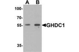 Western blot analysis of GHDC in 293 cell lysate with GHDC antibody at  (A) 0. (GHDC anticorps  (N-Term))