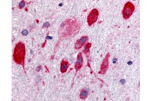 Anti-GPR171 antibody IHC of rat brain, neurons.