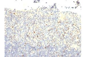 Formalin-fixed, paraffin-embedded human Tonsil stained with FOXP3 Monoclonal Antibody (FXP3/197).