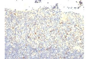 Formalin-fixed, paraffin-embedded human Tonsil stained with FOXP3 Monoclonal Antibody (FXP3/197). (FOXP3 anticorps)