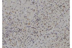 ABIN6273704 at 1/100 staining Human liver tissue by IHC-P.