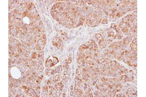 IHC-P Image Immunohistochemical analysis of paraffin-embedded SW480 xenograft, using TRAF1, antibody at 1:100 dilution. (TRAF1 anticorps)