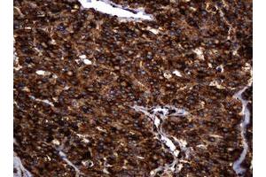 Image no. 9 for anti-Pogo Transposable Element with KRAB Domain (POGK) antibody (ABIN1500329)