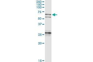 Immunoprecipitation of NEFL transfected lysate using anti-NEFL MaxPab rabbit polyclonal antibody and Protein A Magnetic Bead , and immunoblotted with NEFL purified MaxPab mouse polyclonal antibody (B01P) . (NEFL anticorps  (AA 1-543))