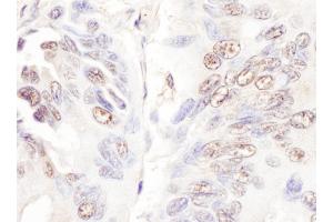 Immunohistochemistry (IHC) image for anti-Cyclin-Dependent Kinase-Like 5 (CDKL5) (AA 350-400) antibody (ABIN7453908) (CDKL5 anticorps  (AA 350-400))