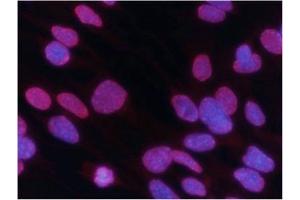 Immunofluorescence staining of methanol-fixed MEF cells using Histone H3 (Tri-Methyl-Lys27) Antibody .