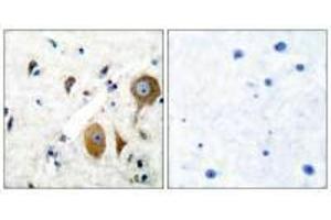 Immunohistochemical analysis of paraffin-embedded human brain tissue using GluR8 antibody. (GRM8 anticorps)