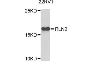 Western blot analysis of extracts of 22Rv1 cells, using RLN2 antibody. (Relaxin 2 anticorps)