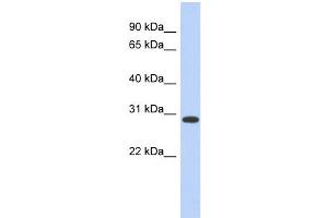WB Suggested Anti-HOXD12 Antibody Titration:  0. (HOXD12 anticorps  (Middle Region))