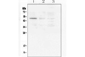 Western blot analysis of Caspase-2 using anti-Caspase-2 antibody (ABIN6719550).