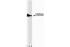 Western blot analysis of Adaptin beta on a Jurkat cell lysate (Human T-cell leukemia, ATCC TIB-152) (left). (AP2B1 anticorps  (AA 75-245))