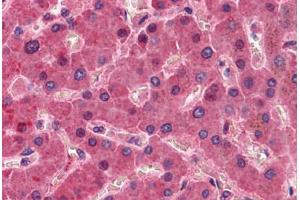 Liver, Human: Formalin-Fixed, Paraffin-Embedded (FFPE) (F12 anticorps)