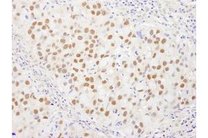 Immunohistochemistry (IHC) image for anti-Werner Helicase Interacting Protein 1 (WRNIP1) (AA 400-450) antibody (ABIN7449035)