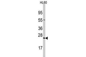 Western blot analysis of TRAPPC4 polyclonal antibody  in HL-60 cell line lysates (35 ug/lane). (TRAPPC4 anticorps  (N-Term))