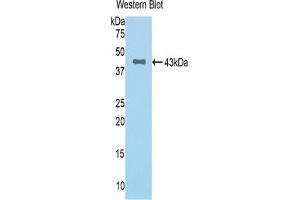 Detection of Recombinant CFB, Rat using Polyclonal Antibody to Complement Factor B (CFB) (Complement Factor B anticorps  (AA 34-159))