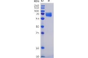 Human SL Protein, mFc-His Tag on SDS-PAGE under reducing condition.