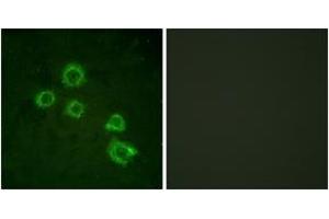Immunofluorescence analysis of HuvEc cells, using c-PLA2 (Ab-505) Antibody. (C-PLA2 (AA 471-520) anticorps)