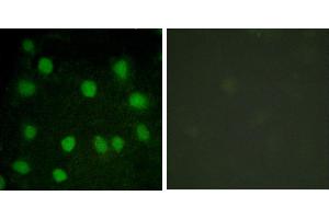 serum + -Immunofluorescence analysis of HuvEc cells, treated with serum (20%, 30mins), using Dematin (Ab-403) antibody. (Dematin anticorps  (Ser403))
