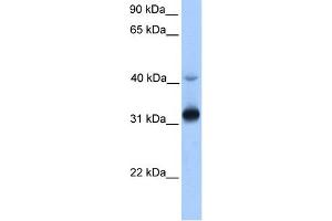 WB Suggested Anti-GPSN2 Antibody Titration:  0. (TECR anticorps  (Middle Region))