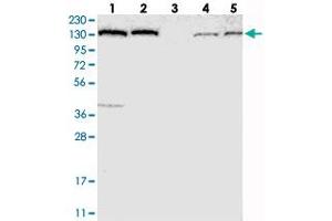 Western blot analysis of Lane 1: RT-4, Lane 2: U-251 MG, Lane 3: Human Plasma, Lane 4: Liver, Lane 5: Tonsil with PFAS polyclonal antibody  at 1:250-1:500 dilution.