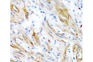 Immunohistochemistry of paraffin-embedded Human colon using LMOD1 Polyclonal Antibody at dilution of 1:200 (40x lens). (Leiomodin 1 anticorps)