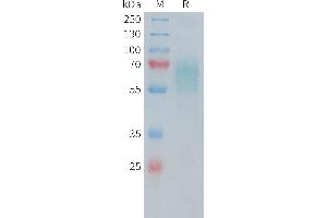 Human CD30 Protein, His Tag on SDS-PAGE under reducing condition.